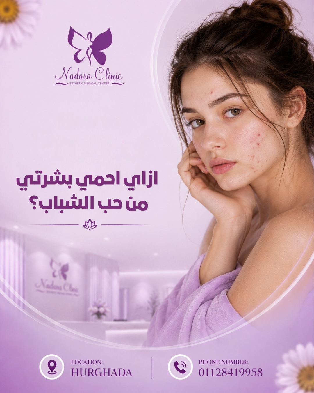 ازاي أحمي بشرتي من حب الشباب في الغردقة